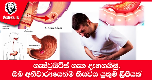 sinhala-articles-ගැස්ට්‍රයිටිස්-ගැන-දැනගනිමු-Health