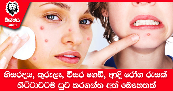 sinhala-articles-හිසරදය-කුරුලෑ-විසර-ගෙඩි-ආදී-රෝග-රැසක්-නිට්ටාවටම-සුව-කරගන්න-මේ-අත්-බෙහෙත්-හදාගන්න-Health