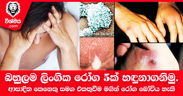 sinhala-articles-බහුලම-ලිංගික-රෝග-5ක්-හඳුනාගනිමු-SexEducation