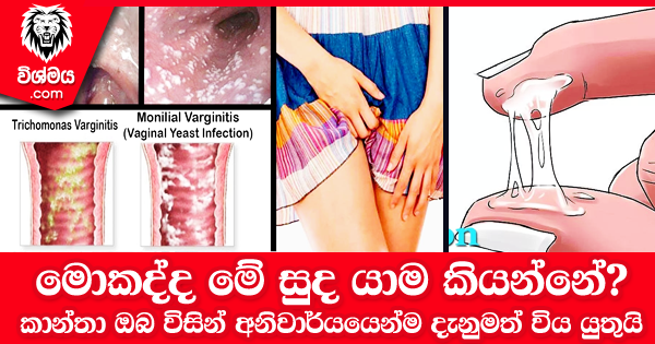 sinhala-articles-මොකද්ද-මේ-සුද-යාම-කියන්නේ-කාන්තා-ඔබ-විසින්-අනිවාර්යයෙන්ම-දැනුමත්-විය-යුතුයි-SexEducation